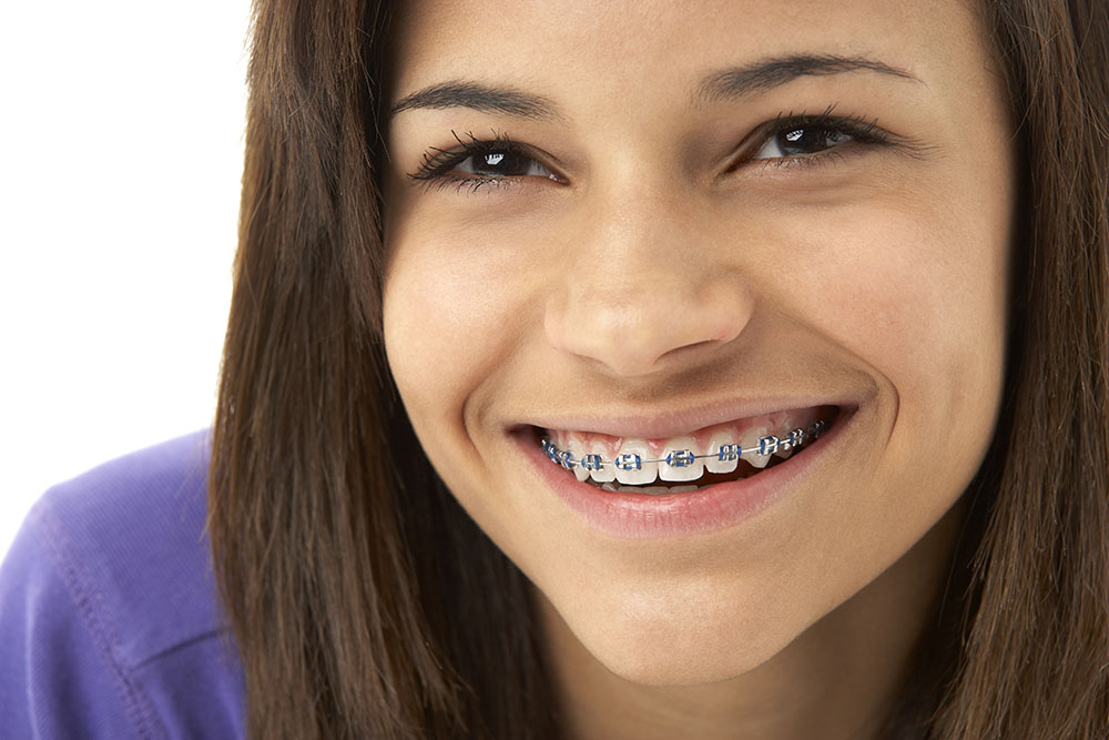 brasssmile
